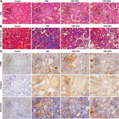 Polyporus Umbellatus Protects Against Renal Fibrosis by Regulating Intrarenal Fatty Acyl Metabolites